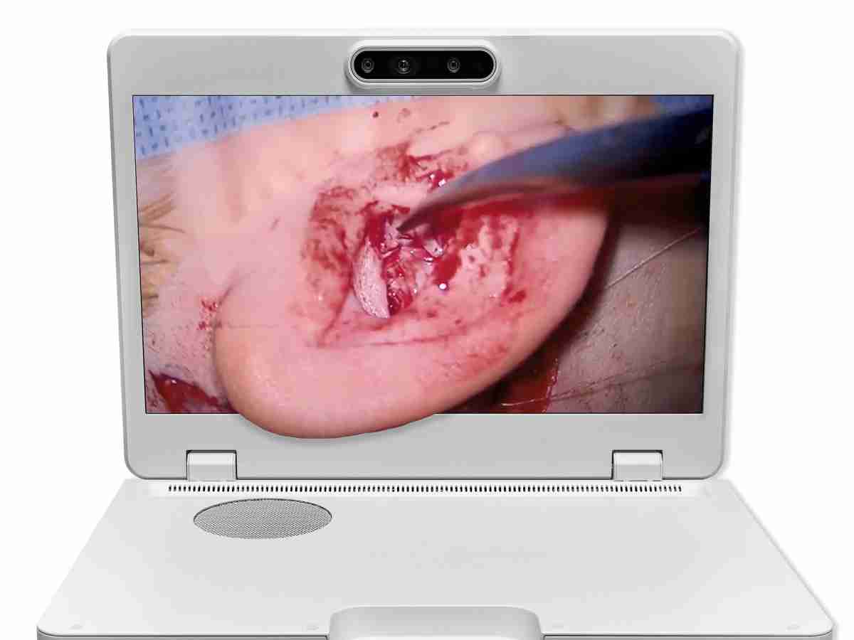 达擎之＂Heads-up 3D显微手术显示系统＂，，整合4K裸眼3D显示及眼球追踪系统，，，，具备快速追踪人眼移动位置功能，，减轻医师长时间维持固定姿势的负担，，，，让医师能有更宽广清晰的3D立体视野及更舒适的姿势来执行手术。。。。